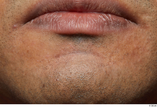 HD Face Skin Henri Sanaky chin face lips mouth skin…